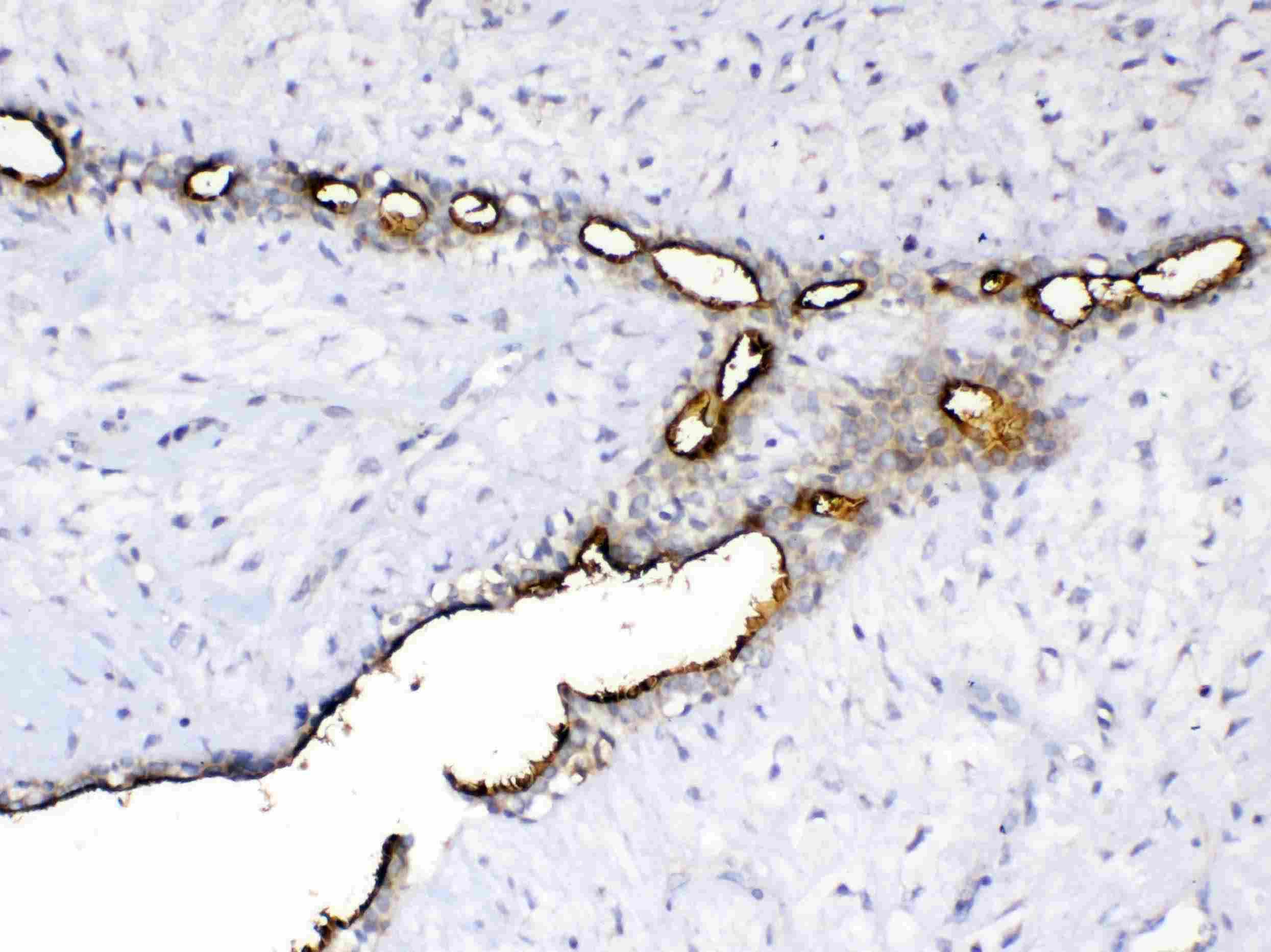 Polyclonal Rabbit anti-Human EMA / MUC1 Antibody (IHC, WB)