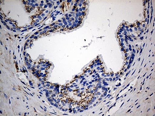 PTPN22 / PEP Antibody (aa359-449, clone OTI6B1)