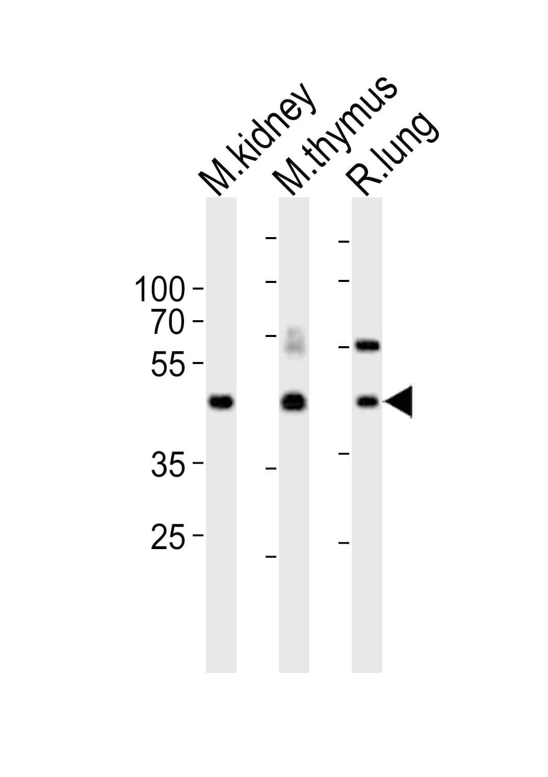DLK1 / Pref-1 Antibody (aa372-405)
