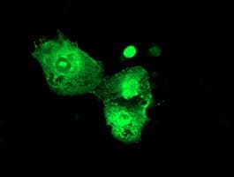 p58 / PSMD3 Antibody (clone OTI2C2)