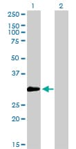 ZNF174 Antibody (clone 2D7-E9)