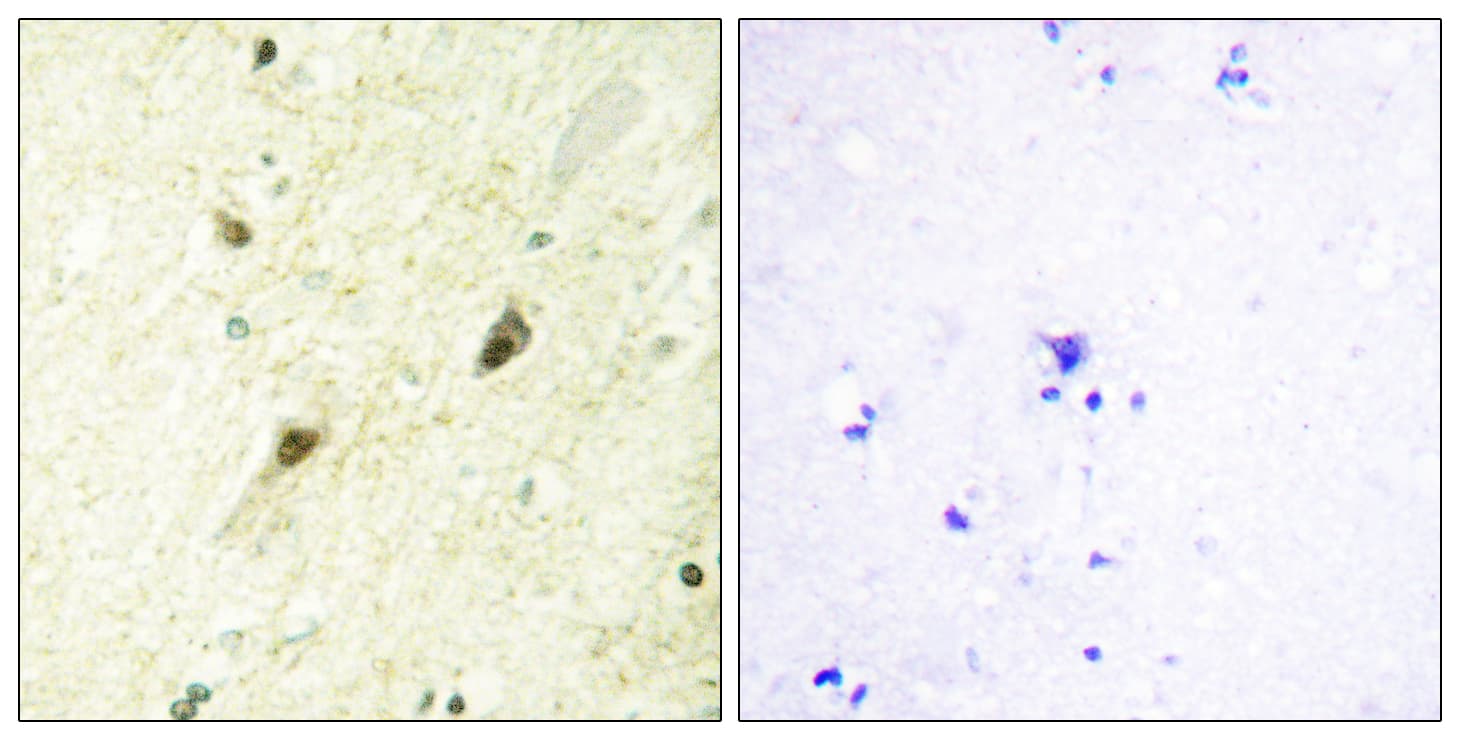 Polyclonal Rabbit anti-Human GLI3 Antibody (aa11-60, IHC, IF)