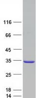 Human RAB27A / RAB27 Protein (Recombinant Myc-DDK (Flag))