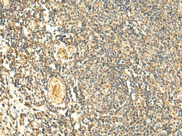 Polyclonal Rabbit anti-Human ATP5H Antibody (IHC, WB)
