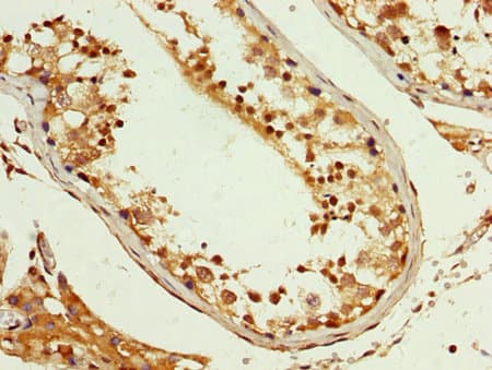 HNRNP-E2 / PCBP2 Antibody