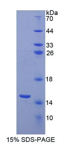 Human ACYP1 Protein (Recombinant His-T7)