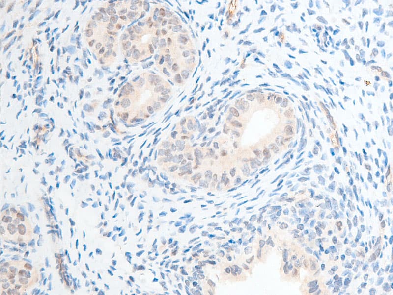 CHEK2 / CHK2 Antibody (phospho-Thr68)