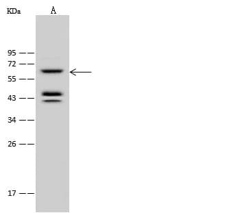 Polyclonal Rabbit anti-Human PPP2R1A Antibody (WB)