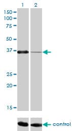 Monoclonal Mouse anti-Human PITX1 Antibody (clone 5G4, WB)