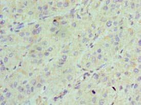 AK2 / Adenylate Kinase 2 Antibody (aa1-232)