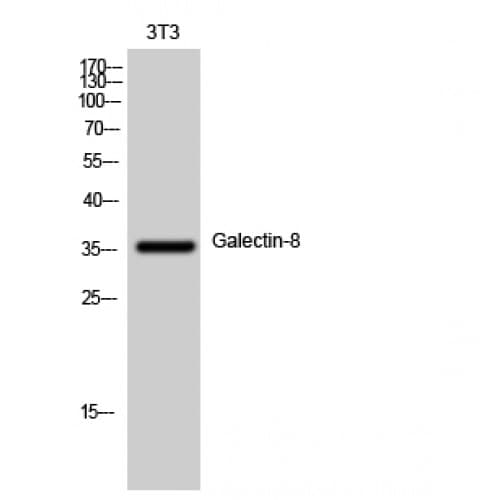 LGALS8 / Galectin 8 Antibody (30-110 aa, Internal)