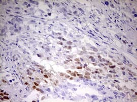 TIPIN Antibody (clone OTI2C10)