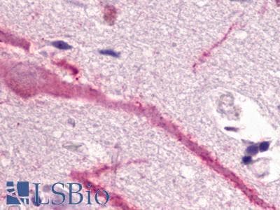PathPlus™ Polyclonal Rabbit anti-Human GPR160 Antibody (Transmembrane Domain, IHC)