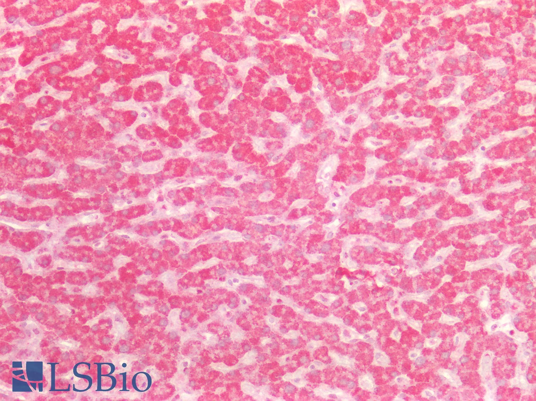 PathPlus™ SDHB Antibody (aa1-150)
