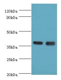 Polyclonal Rabbit anti-Human CD1A Antibody (aa21-181, WB)