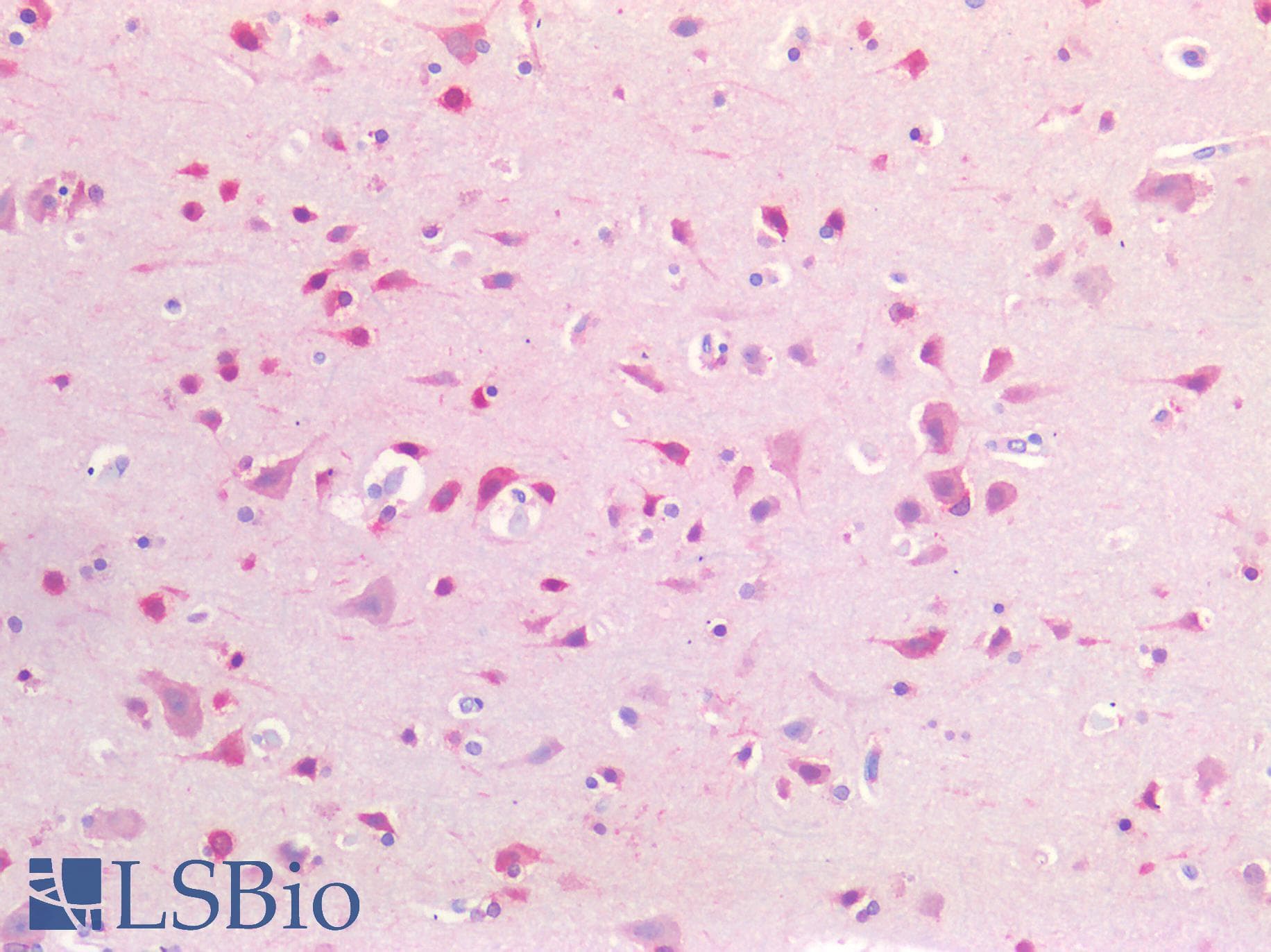 IHC-plus™ CSPG4 / NG2 Antibody