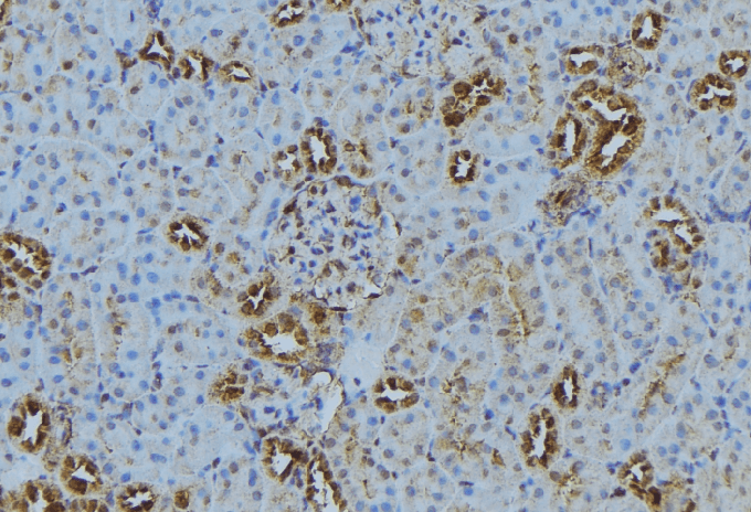Polyclonal Rabbit anti-Human MKS1 Antibody (IHC, WB)
