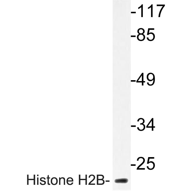 Histone H2B Antibody (Lys5)