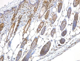 NBN / Nibrin Antibody (Internal)