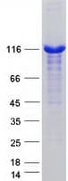 Human USP4 Protein (Recombinant Myc-DDK (Flag))