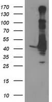 MAPRE2 / EB2 Antibody (clone OTI4G1)