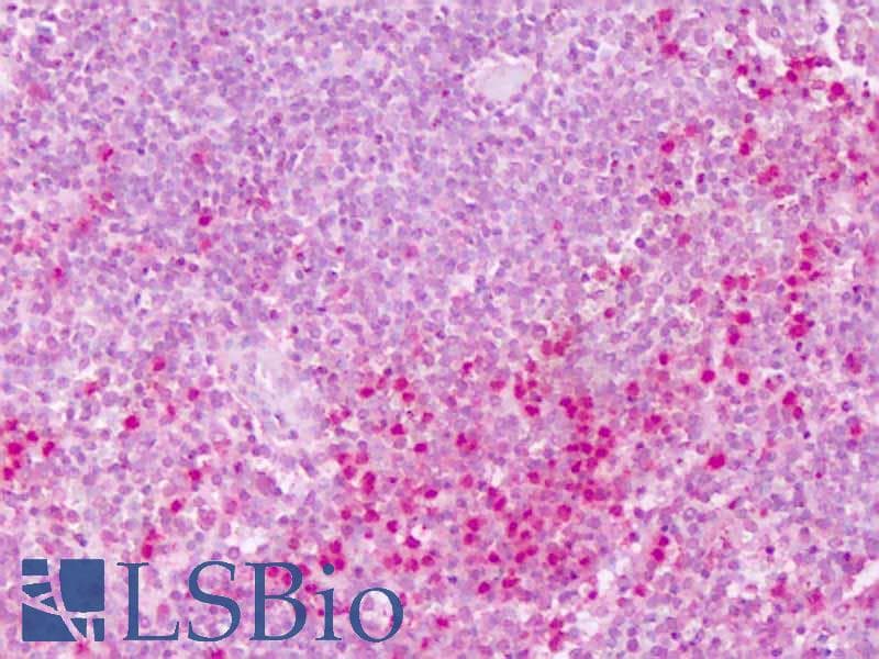 IHC-plus™ PTPRE / PTP Epsilon Antibody (Cytoplasmic Domain)