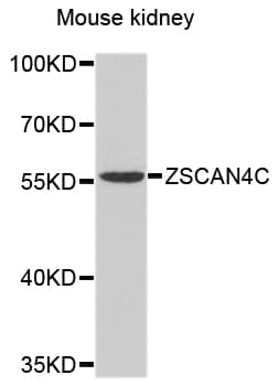 Polyclonal Rabbit anti-Mouse Zscan4c Antibody (WB)
