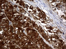 Monoclonal Mouse anti-Human NME1 / NM23 Antibody (clone OTI7F2, IHC, WB)