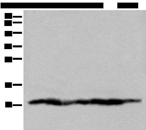 UQCRQ Antibody