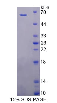 Rat CYP11B1 Protein (Recombinant His-T7)
