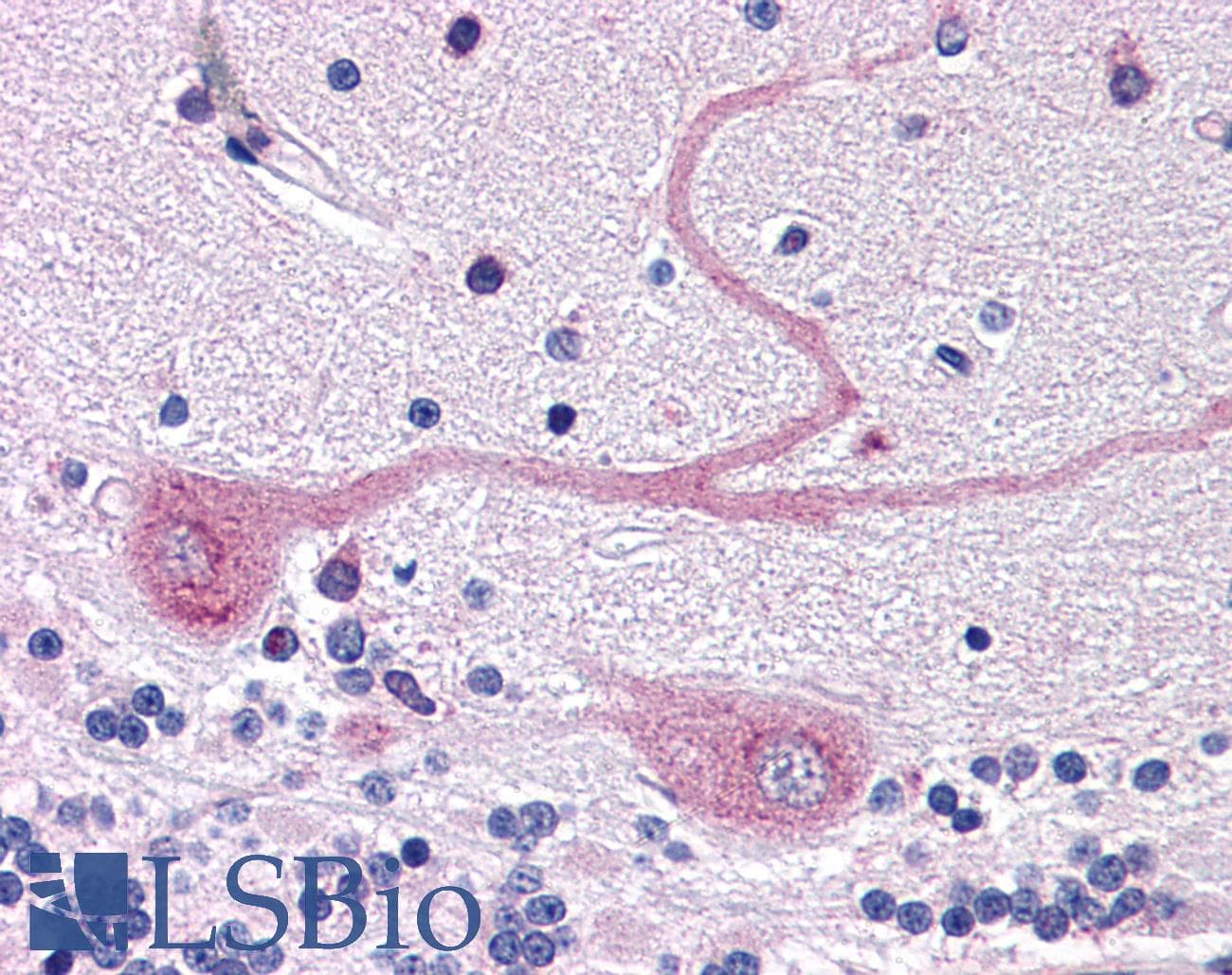 IHC-plus™ MANF / ARMET Antibody