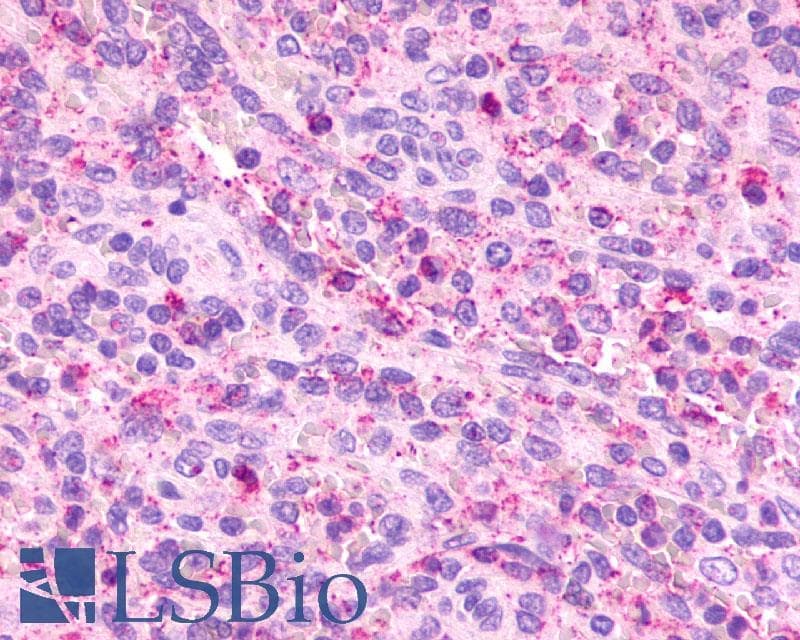 PathPlus™ Polyclonal Rabbit anti-Human CXCR2 Antibody (Extracellular Domain, IHC)