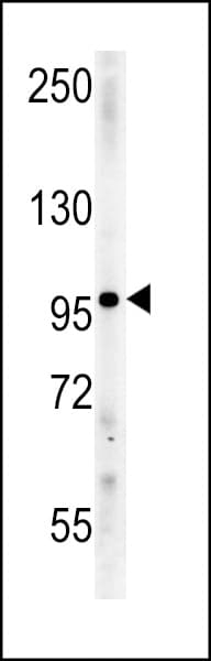 Polyclonal Rabbit anti-Human IPO9 / Importin 9 Antibody (aa79-106, IHC, WB)
