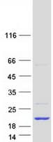 Human ENSA Protein (Recombinant Myc-DDK (Flag))