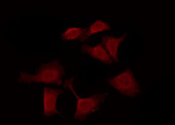 Polyclonal Rabbit anti-Human OR10J6P Antibody (IF, WB)