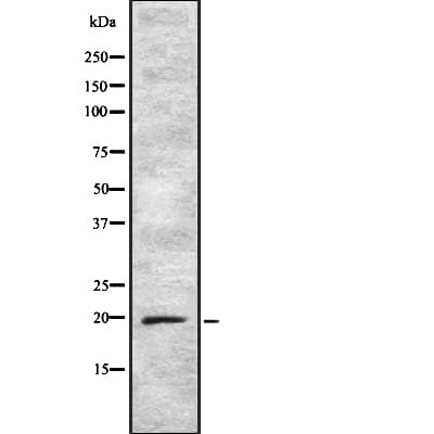 ARF5 Antibody