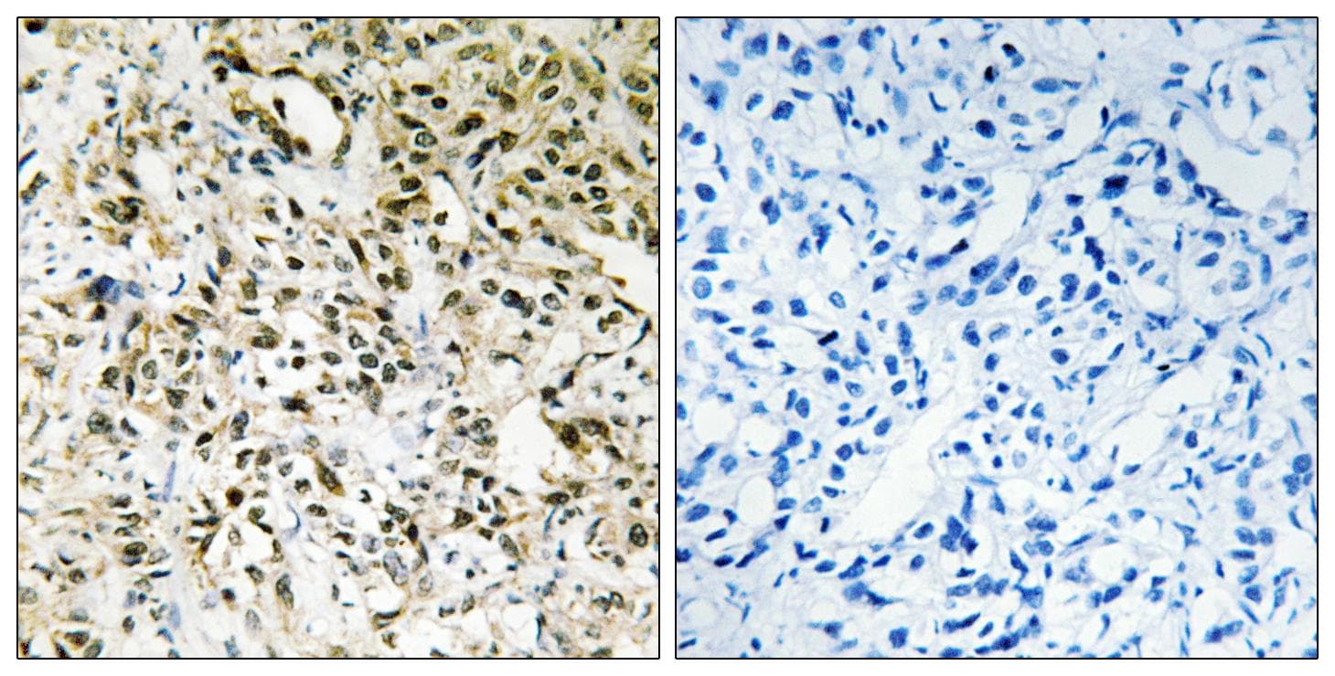 PPHLN1 Antibody