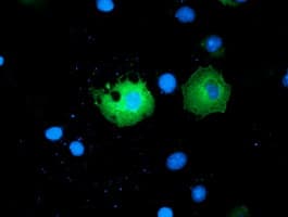 PAICS / ADE2 Antibody (clone OTI8A1)