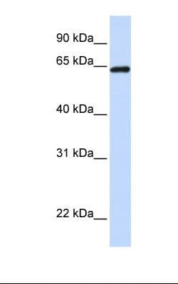 LCP1 / L-Plastin Antibody (aa506-555)