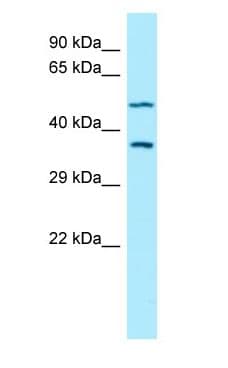 AKR1A1 Antibody (aa50-99)