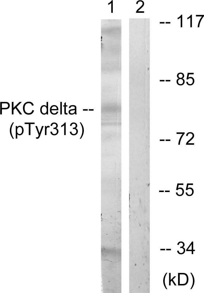 Polyclonal Rabbit anti-Human PRKCD / PKC-Delta Antibody (phospho-Tyr313, IHC, WB)
