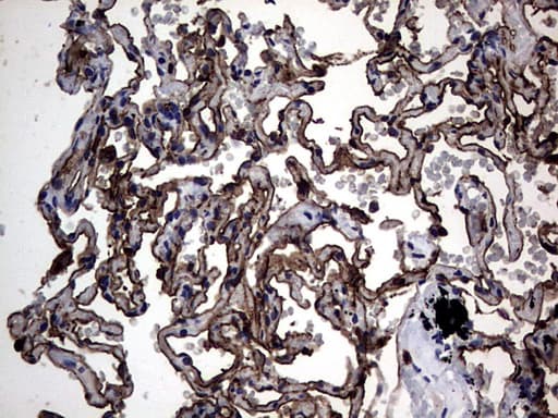 Monoclonal Mouse anti-Human CEACAM5 / CD66e Antibody (clone OTI5F2, aa35-680, IHC, WB)