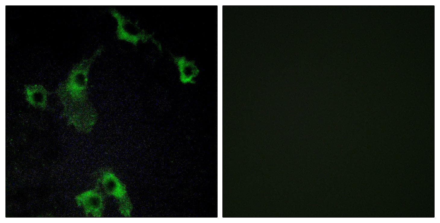 CIDEB Antibody