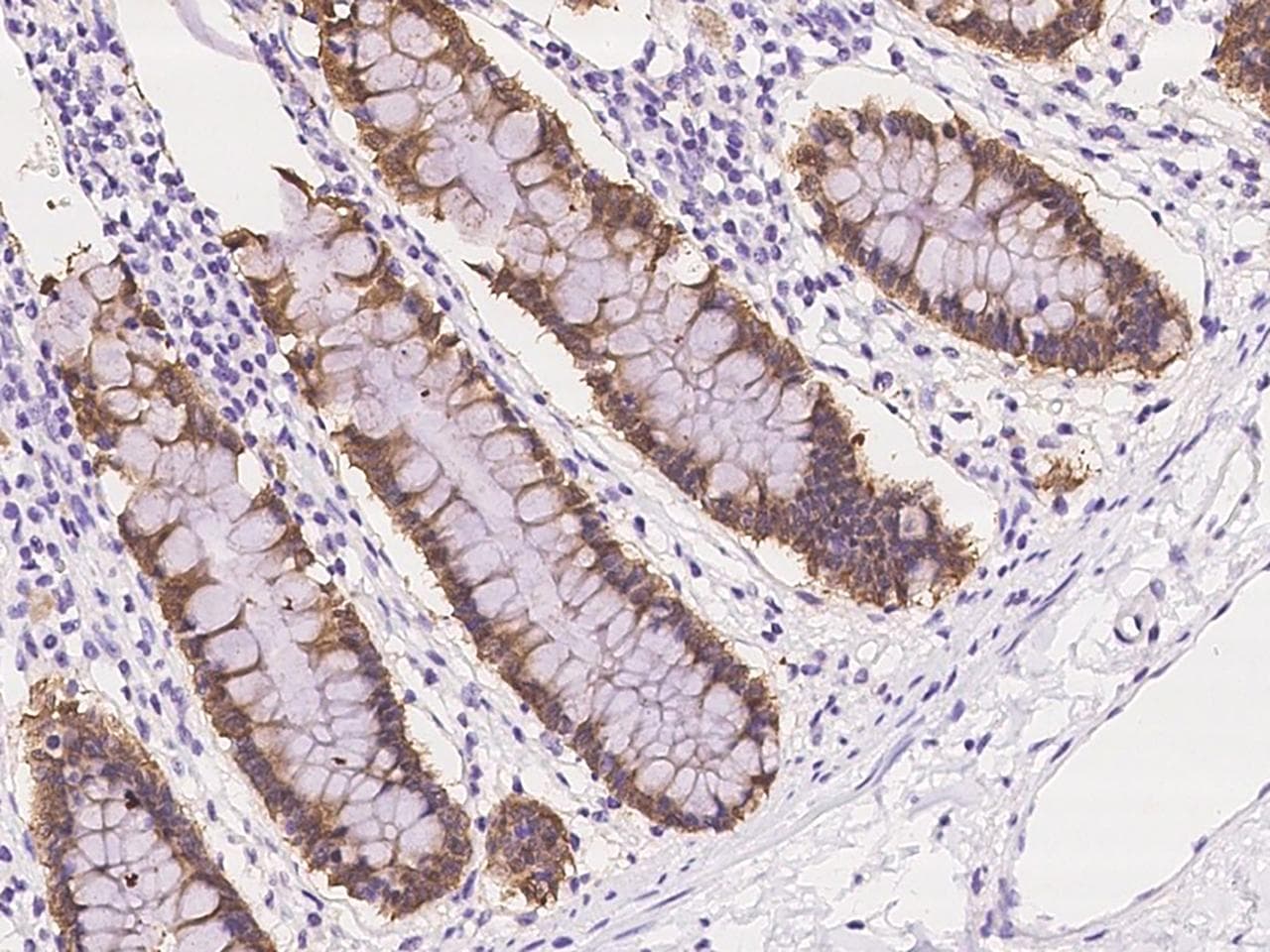GAL4 / Galectin 4 Antibody