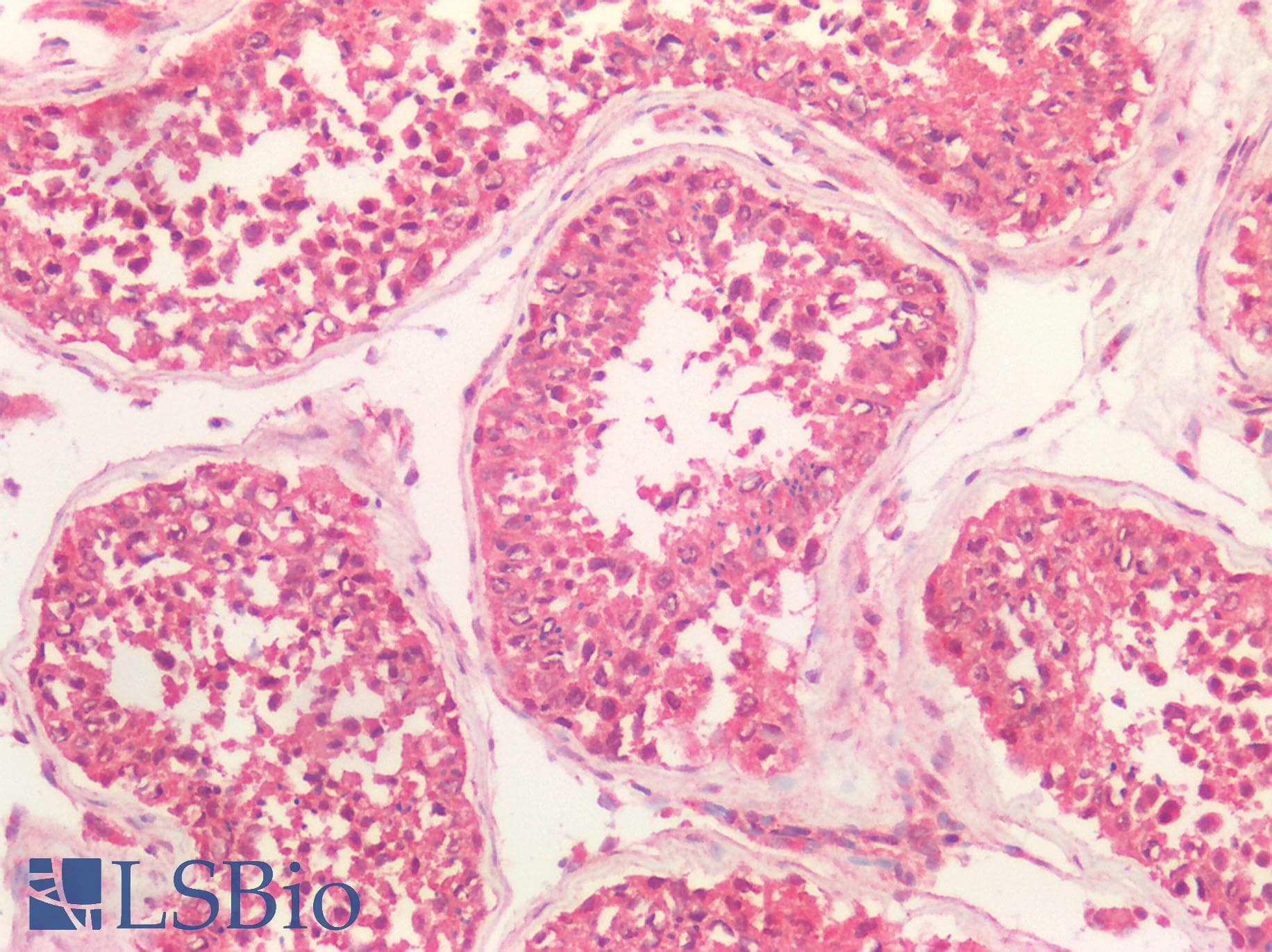 Polyclonal Rabbit anti-Human SMO / Smoothened Antibody (IHC, IF, WB)