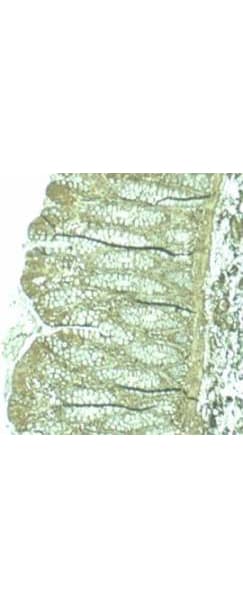 IHC-plus™ Polyclonal Rabbit anti-Human PDCD4 Antibody (IHC, WB)