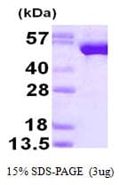 Human GSR / Glutathione Reductase Protein (Recombinant His)