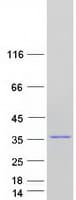 Human TCEAL3 Protein (Recombinant Myc-DDK (Flag))