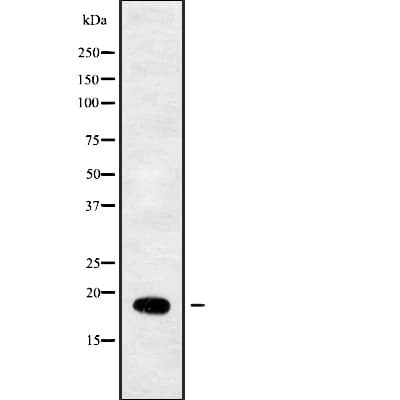RPL29 / Ribosomal Protein L29 Antibody