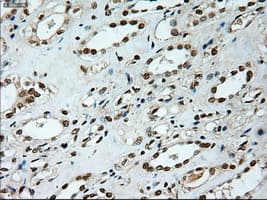 NOTCH1 Antibody (clone OTI3E12)